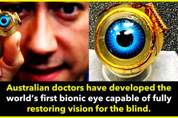 Australian Doctors Unveil World’s First Bionic Eye to Fully Restore Vision World’s First Bionic Eye