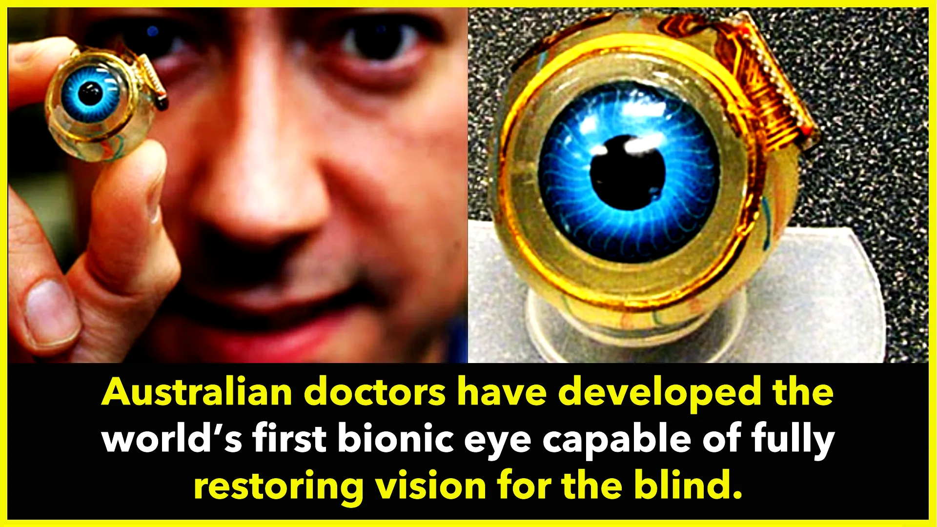 World’s First Bionic Eye