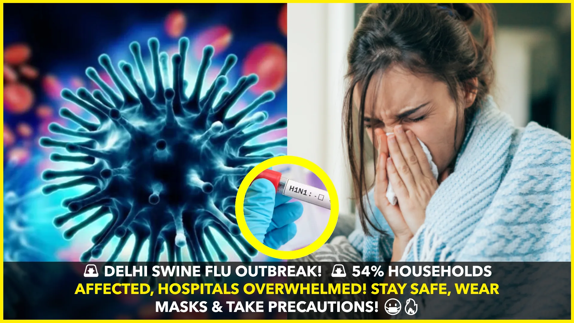Delhi Sees Surge in Swine Flu Cases: 54% Households Affected, Hospitals Overwhelmed