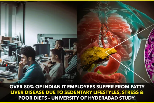 Over 80% of Indian IT Employees Suffer from Fatty Liver Disease: University of Hyderabad Study Over 80% of Indian IT Employees Suffer from Fatty Liver Disease: University of Hyderabad Study