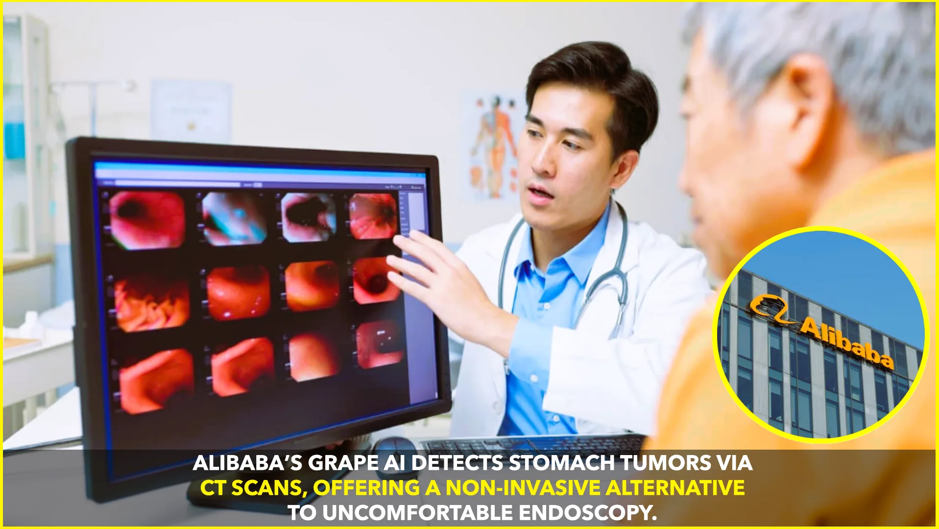 Alibaba’s Grape AI Spots Stomach Tumors via CT Scans